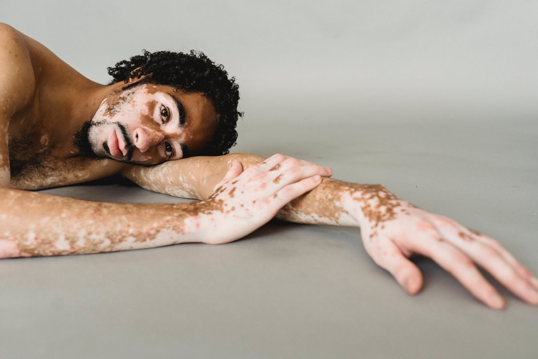 black man with vitiligo lying on floor of studio